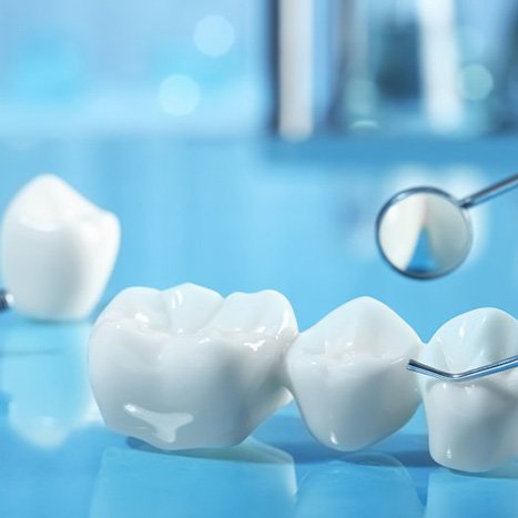 Close up of a dental bridge next to dental tools