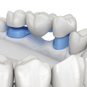 Digital image of a traditional bridge