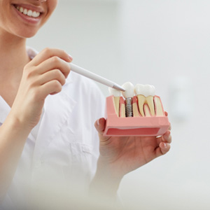 A dentist showing a dental implant model to a patient