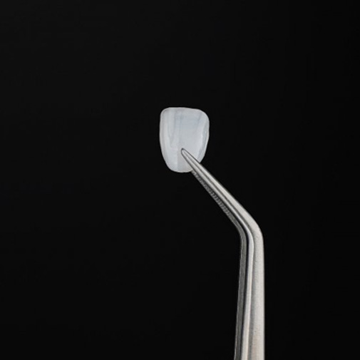 Dental veneer held with tweezers