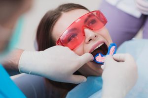 Woman with protective eyewear having fluoride inserted over her arch